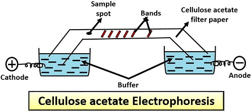 separation of proteins,Biological acetate membrane 