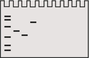 Western blotting ,protein transfer